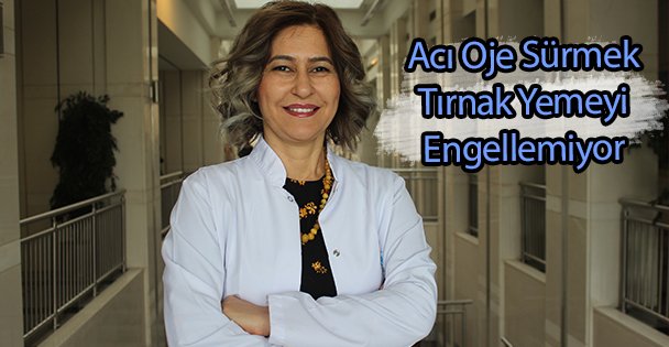 Acı Oje Tırnak Yemeyi Engellemiyor