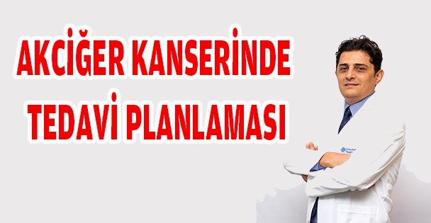 AKCİĞER KANSERİNDE TEDAVİ PLANLAMASI