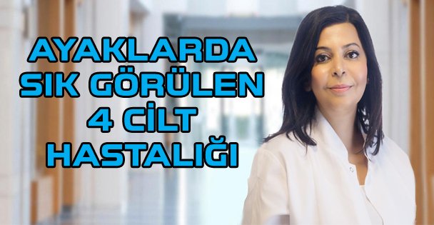 Ayaklarda sık görülen 4 cilt hastalığı