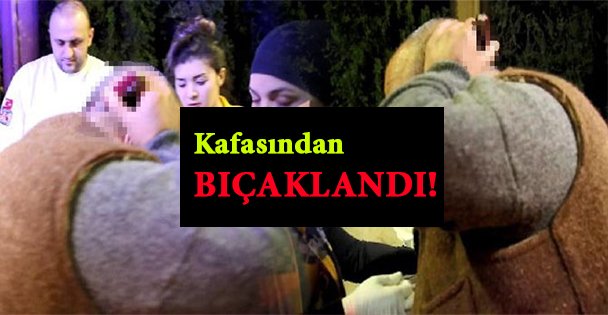 Kafasından Bıçaklandı!