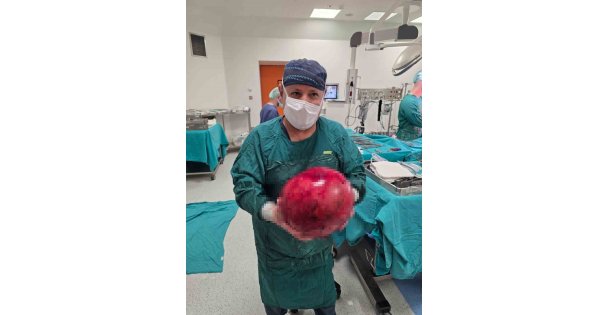 Doktorlar gözlerine inanamadı: 1,5 yıl ertelediği ameliyatta karnından dev kitle çıktı