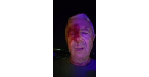 Haber yaparken saldırıya uğrayan muhabir yaralandı