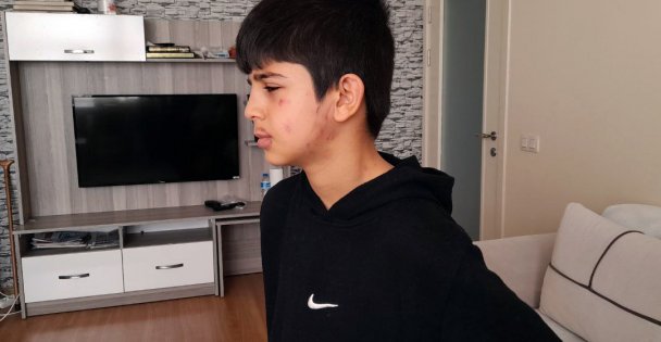 Köpeğin Yaraladığı Çocuk Tedavi Edildi