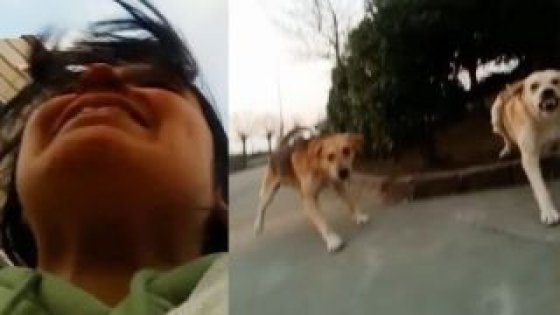 Köpek saldırısına uğrayan öğrenci o anları paylaştı