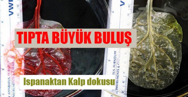 Sağlıkta Yeni Bir Buluş Daha