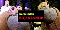 Kafasından Bıçaklandı!