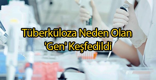 Tüberküloza Neden Olan 'Gen' Keşfedildi